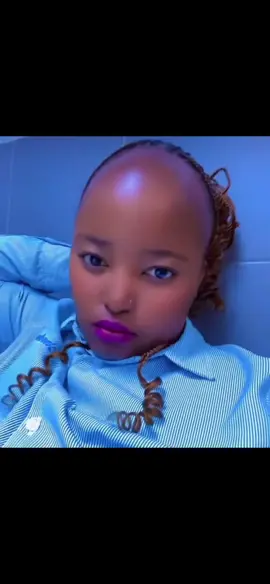 #foreheadreduction #hairregrowthtreatment #minoxidilresult #hairlosssolutions #hairloss #hairlosssolutionsforwomen #hairgrowth #recedinghairline #hairlosshelp