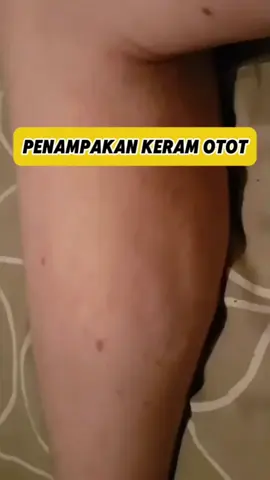 Kram otot yang bikin ngilu #viral #fyp #reels #faktaunik #faktadunia #faktamenarik #infounik #fakta #faktaunik #viral #info #wowfakta #faktadunia #kamuharustau #faktamenarik #faktanyagoogle #infounik #TikTokCreatorSearchInsightsIncentive 