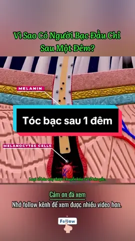 Chỉ sau một đêm, tóc có thể chuyển sang bạc trắng – nguyên nhân là gì? Tìm hiểu bí mật đằng sau hiện tượng này, từ căng thẳng đến những yếu tố sinh học bí ẩn. #suckhoe #khoahoc #cothebanchuabiet 