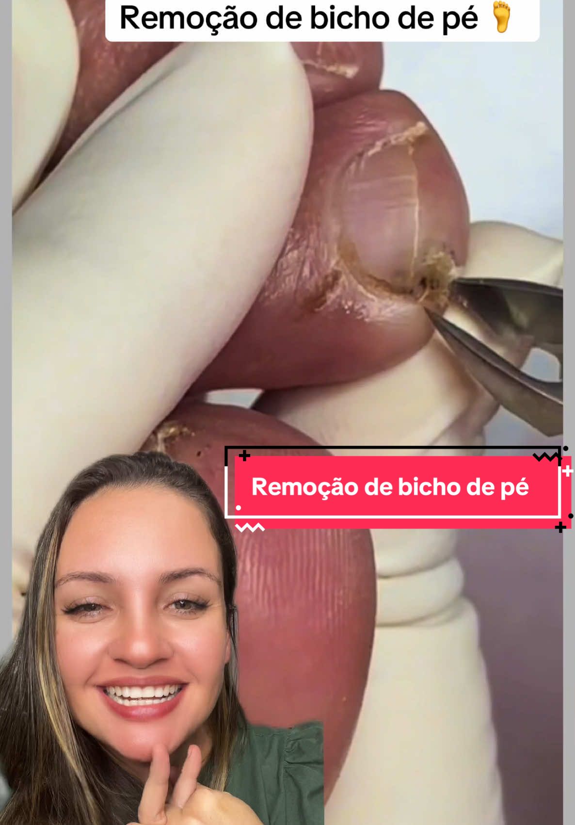 Bora que ta top #bichodepe #terapia #reagindo #satisfatório #limpezasatisfatoria 