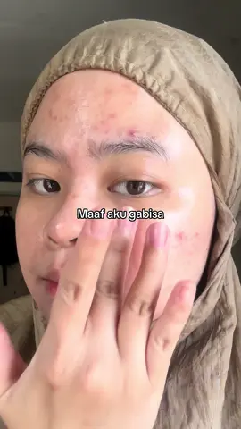 Gabisaa jauh dari dia🥹#acnefighter #acneprone #moisturizerviral #skincareroutine 