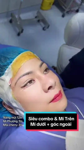 Trả lời @Bảo Hân EM MUỐN LÀM MÍ PHƯỢNG + MŨI BÁN CẤU TRÚC BAO NHIÊU #xuhuong #LearnOnTikTok #nangmui #nangmuiphongthuy #nangmuisline #nangmuicautruc 