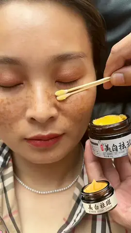 #CapCut Freckles whitening #fyp #skincare #goodthing 