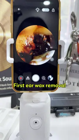 if youre not using these, START é ear wax removal tool withcamera #earwax#earwaxremmoval#oddlysatisfyingtiktok#foryou #pimple #earcleaning #earwax#blackhead#relax #acne #satisfying #asmr#earcleaningvideos #ceradeouvido #earwaxcleaning#limpezadeouvido