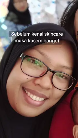 Skincare ter ngaruh yang pernah ku pake #dnasalmon #skincareviral #skincaretips #skincarednasalmon #salmondna #dnasalmonsr12 #sr12skincare 