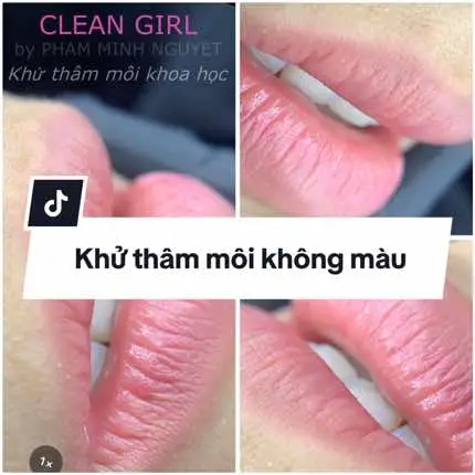 𝙋𝙤𝙨𝙩 𝙣𝙖̀𝙮 𝙙𝙖̀𝙣𝙝 𝙧𝙞𝙚̂𝙣𝙜 𝙘𝙝𝙤 𝙘𝙝𝙞̣ 𝙚𝙢 𝙩𝙝𝙞́𝙘𝙝 𝙈𝙊̂𝙄 𝙆𝙃𝙊̂𝙉𝙂 𝙈𝘼̀𝙐 Liệu trình khử thâm môi cải tiến bên Nguyệt sẽ biến những đôi môi THÂM thành những đôi môi “𝙠𝙝𝙤̂𝙣𝙜 𝙢𝙖̀𝙪”.  Không màu ở đây không phải là tái trắng, mà là những đôi môi sau bong mang màu 𝙝𝙤̂̀𝙣𝙜 𝙨𝙞𝙣𝙝 𝙡𝙮́ trong trẻo tự nhiên, sắc tố thâm được giảm hết mức có thể, cân bằng sắc tố giữa lòng môi và viền môi, tạo nên tác phẩm một đôi môi mang tính thẩm mỹ hơn so với trước đó.  Liệu trình này phù hợp với tất cả chị em chúng ta, đặc biệt là với học sinh - sinh viên, hay đơn giản hơn là những ai thích sự tự nhiên. Gu này còn phù hợp với chị em Anti ( ghét) phun xăm đó nha hihi, vì làm xong đâu biết mình đã từng phun xăm đâu 😛  —————————  Với kinh nghiệm khử thâm hơn 1000 KH, N rất tự tin về hiệu quả và độ tự nhiên của liệu trình này.  Tết này hãy đến Phun Xăm Phạm Minh Nguyệt làm đẹp và nhận quà nhé 💕💕💕💕  #phunxamphamminhnguyet #khuthammoicantho