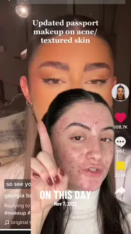 #onthisday 2 years ago!! looking back at this video my skin and face has changed so so much! Coming onto 3 years off of birth control! Still love this type of makeuo though ❤️❤️🥰🥰 #makeuptutorial #passportmakeup #makeupartist #acnemakeup #acnecoverage #unfilteredskin 