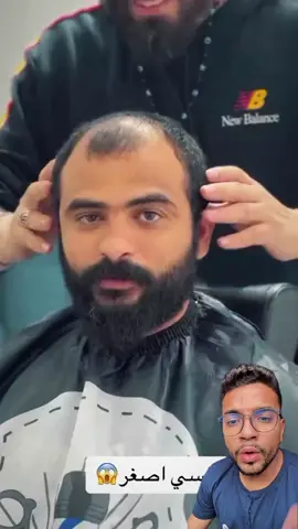 MELHOR CORTE PARA CALVO ? 😱🤩 #calvo #calvicie #calviciemasculina 