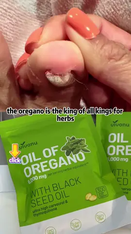 #foryou #oiloforegano #tiktokshop 