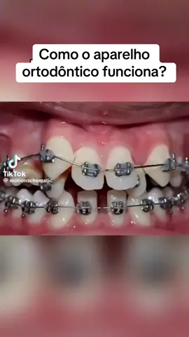 #odontologia #ortodontia 