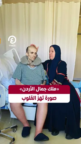 بجسد هزيل وقدمين متورمتين.. صورة تهزّ القلوب  موجة تعاطف عارمة للشاب #أيمن_العلي الملقب بـ 