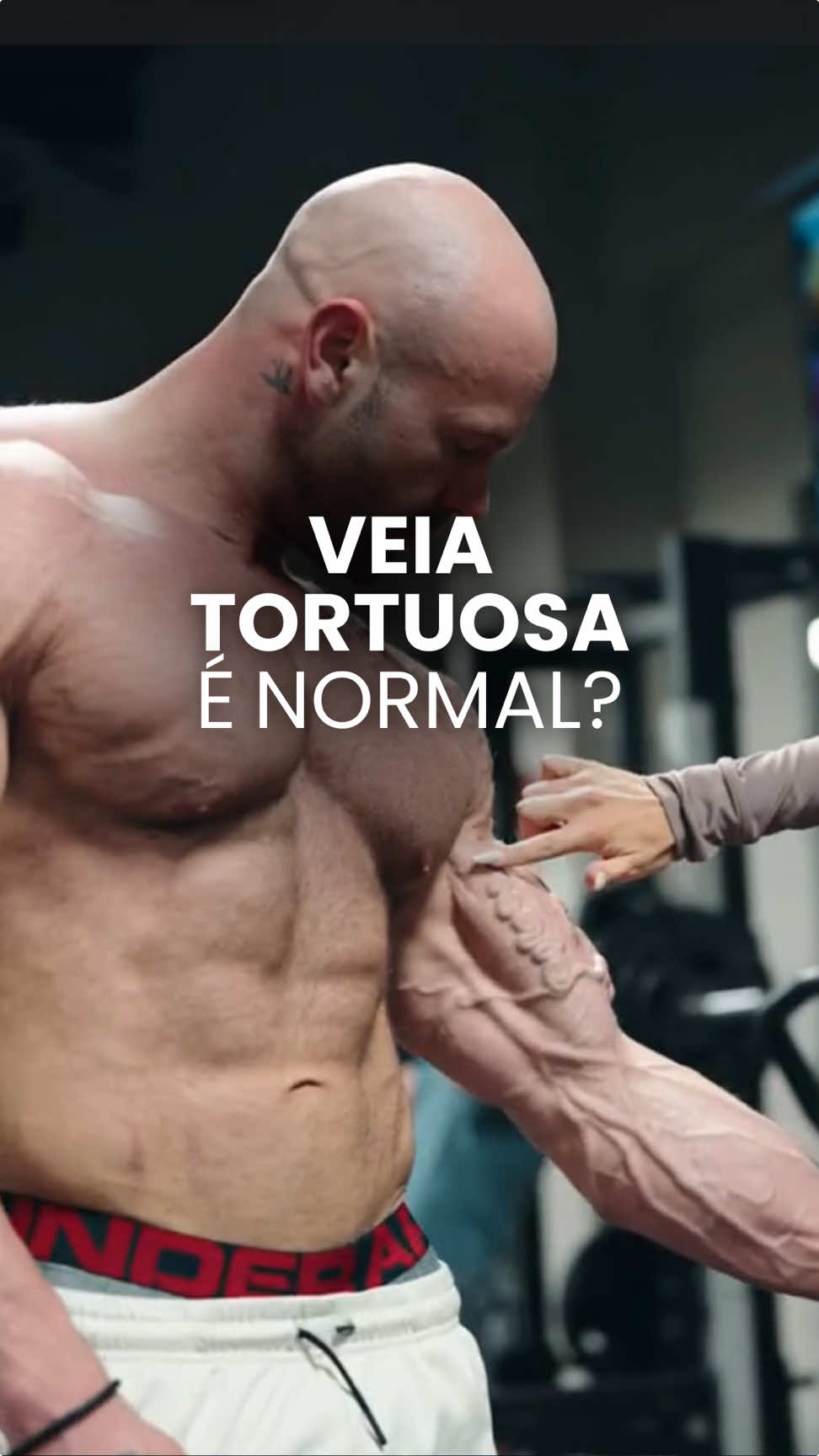 Veia tortuosa é normal? #vascular #musculacao #veins 