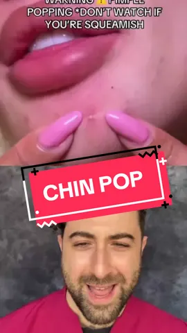 #pimplepatch #pimpleremoval #pimplepopper #pimple #acnewarrior #blackhead #cyst #acne #skincare #pimplepopping 