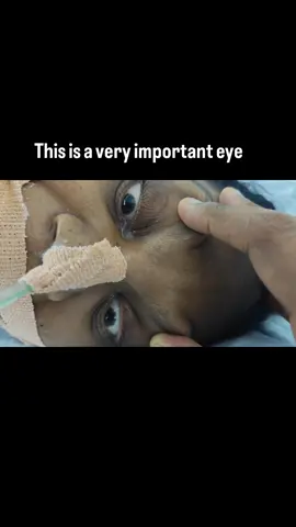 This is very useful icu eye finding which ll tell you why the pt is comatose. Due to cortical dysfunction or brainstem dysfunction  Causes include drugs/toxins/hypoxic encephalopathy/b/l strokes etc CALL IT NYSTAGMUS  Have you come across this #BrainHealth #NeuroScience #Neurologist #NeurologyAwareness #BrainScience #Neuro #Neurology #Neurologist #NeurologyAwareness #BrainScience #NeurologicalDisord #NeurologyUpdates #NeurologyLife #NeurologyClinic #NeurologyConferenceb #NeurologyFacts #NeurologyCaseStudy #NeurologyCommunity #NeurologyResidents #NeurologyConference #NeurologyConsultant     #instahealth #instaeducation #neetpg #neetss   #clinicalneurology #physicians #internalmedicine #mbbs #ophthalmology #eyesignsinicu #neuroophthalmology 