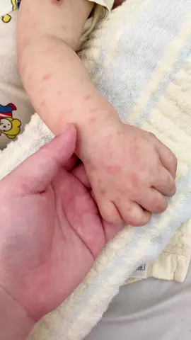 mau khoẻ nhé con . mùa này các bé hay dễ bị bệnh sởi . dịch tay chân miệng . nên các mom chú ý bé nha #embedangyeu ##embe 