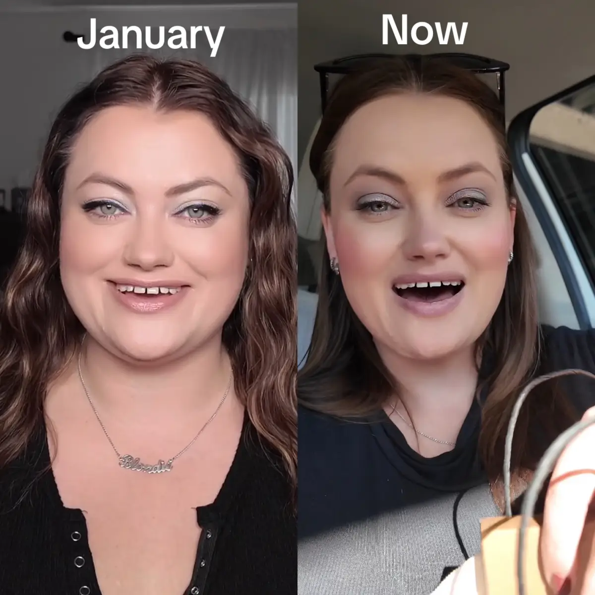 So much can change in a year, sometimes when you’re living in it, you cant see how much you’ve grown. Thank you for being along for the journey #glp1 #growth #growthmindset 