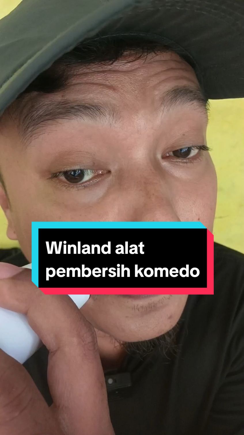 Winland alat pembersih komedo.  #alatpembersihkomedo #winland #pembersihkomedo #cuantanpabatas #gebyarbelanjanovember 