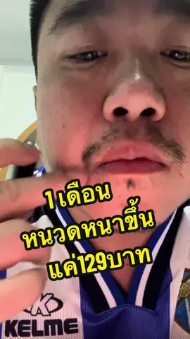 หนวดผมหนาขึ้นมากๆ หลังใช้เฟิ้มเซรั่ม หัวลูกกลิ้ง #เฟิ้มเซรั่ม #เซรั่มปลูกผม #ปลูกหนวด 