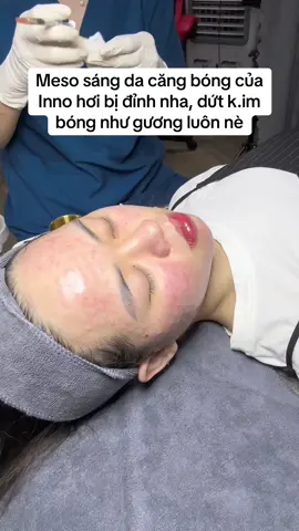 Hơi buot xiu thoi nhưg mê lắm nhaa #ViralBeauty #phuongthaospacosmetic #mesopeel #Phuongthaodmp #duocmypham #mesocangbong 
