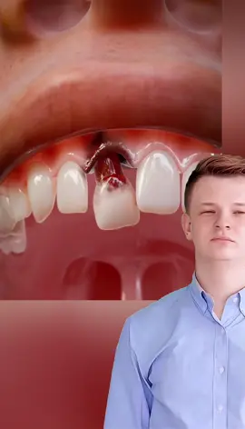 What if you swallowing tooth!! #fyp #facts #factsdaily #animation #knowledge #DidYouKnow #LearnOnTikTok #animationexplainer 