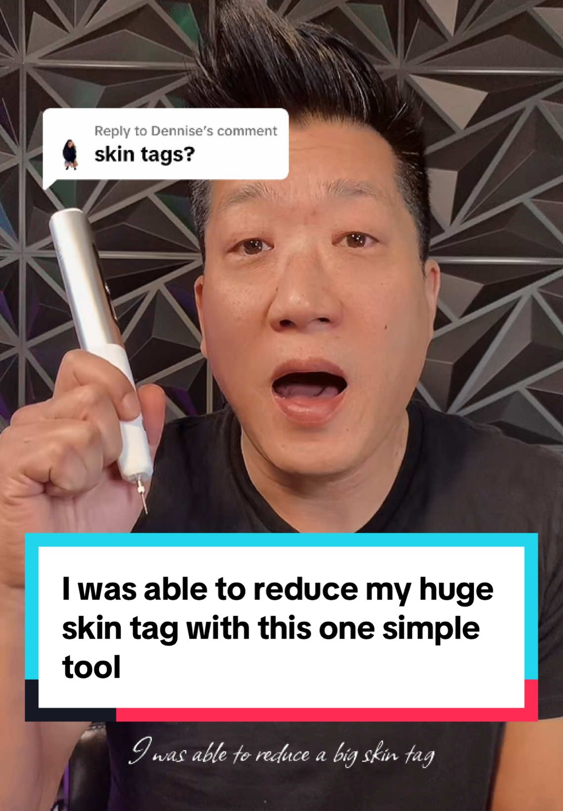 Replying to @Dennise I was able to reduce my huge skin tag with this beauty pen results may vary ##beauty##BeautyHacks##Skin##SkinCare##Face##makeup