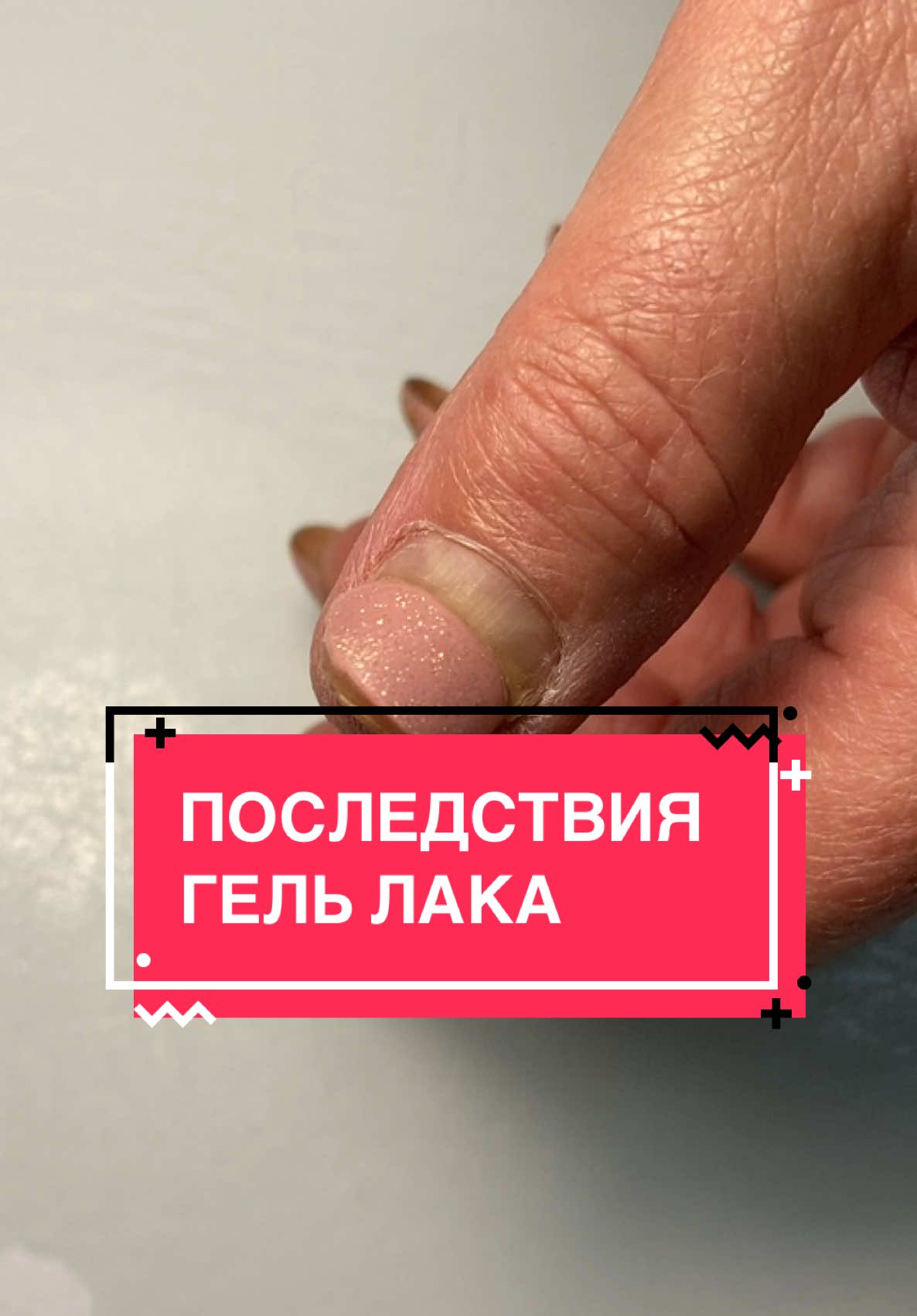 Зачем?! #подологкараганда #подоблогеркз #медицинскийпедикюр #гельлак #грибокногтей#парамедицинскийманикюр 