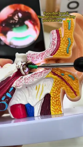 At such a low price these are selling fast i ditched the ear buds and replaced it with this ear pick to remove the wax jnstead #ear #earwax #earwaxremoval#earwaxcleaning #hygine #clean #earwaxremmoval #bargain #tiktokmademebuyit #blackfriday #Uk 