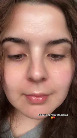 I’ve been thinking about getting some cosmetic intervention, but I always end up deciding against it… 😂 Secret: I started using SPF when I was 20 ❤️ #realskin #skincare #skintok #nosurgery #nofilter #reality #thirties 