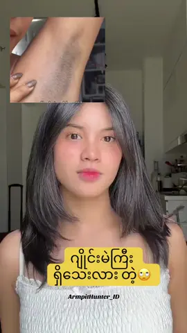 လူကို အထင်သေး😭#chandracream #ကြားဖြူ #ပေါင်ကြားမဲ #chandra #ဂျိုင်းဖြူဆေး 