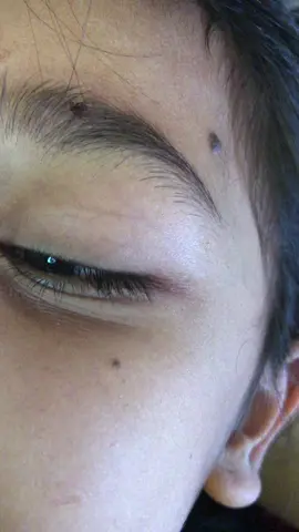 #ticks #tiktok #omg #camping #pubg #ticksremoval #LearnOnTikTok 