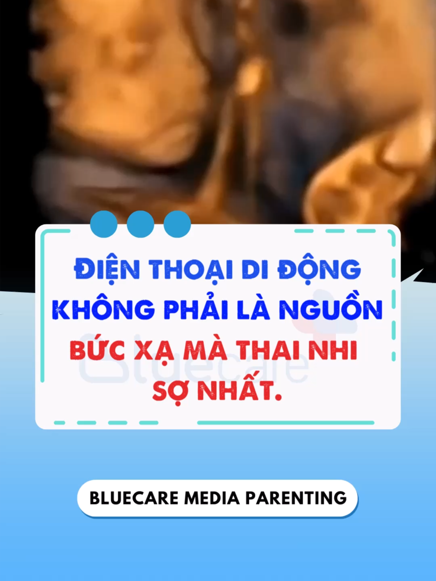 Điện thoại di động không phải là nguồn bức xạ mà thai nhi s.ợ nhất! #mebau #mebauthongthai #pregnant #kienthucmebau #LearnOnTikTok #mangthai