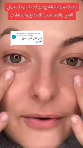 Réponse à @user874460750236 #وصفة لعلاج الهالات السوداء والانتفاخ تحت العين والتجاعيد والخطوط الدقيقه #deutschland #cute #england #francetiktok #videoviral #belgium #maroc #usa_tiktok #treanding #españa #explore #🇺🇸🇬🇧🇪🇦🇲🇦🇪🇺🇨🇦🇨🇵🇪🇭🇹🇳🇩🇪🇧🇪 #