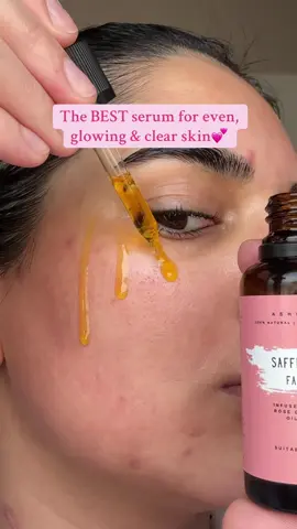 💕🌸 #foryoupage #foryou #trending #skin #skincare #clearskin #acne #acneskin #asiangirl #desi 