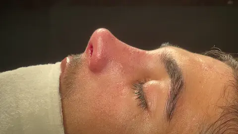 Rhinoplasty Turkey👃 . . . #rhinoplastyturkey#lipfiller#rhinoplasty#nasenkorrekturturkei#rhinoplasty👃🏼✨#rhinoplastybeforeafter#rhinoplastie#rinoplasti#rhinoplastianagrande #burunestetigi#burunestetiği#burunestetiğiizmir
