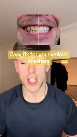 Easy cheap way to get rid of yellow teeth and gain confidence #teethwhitening #howtogetwhiteteeth #teethwhiteninghack #tiktokmademebuyit @Whites Beaconsfield 