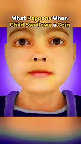 What happend when child swallows a coin ? Medical animation 3D #coinswallow #medicalanimation 