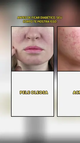 Antes de ficar diabético, seu corpo te mostra isso: #saude #diabetes #curiosidades #interesante #fyp #foryoupagе
