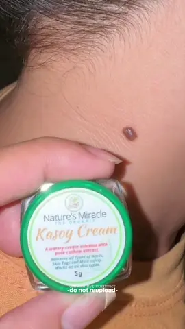 Replying to @Norcia Mabini Abayar Kung malaki man yung tatanggalin alalay nalang sa mga scar remover matatanggal din yan. Try nyo na to 😇 #fyp #kasoycream #mole #warts #skintag #kulugo #naturesmiraclewartsremoval 