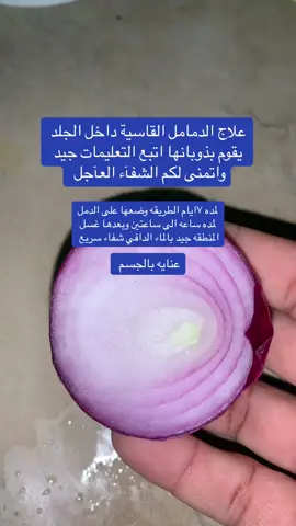 يعالج الدمامل اتبع العليمات جيد #علاج_طبيعي #صحي #عناية_بالجسم #اكسبلور #متابعه_ولايك_واكسبلور_فضلا_ليس_امر #الشعب_الصيني_ماله_حل😂😂 