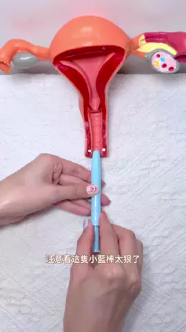 沒想到～～～ 竟然有陰道專用的益生菌🧐 我常常會覺得分泌量很多 需要頻繁換護墊特別是在夏天特別明顯😵‍💫 生理期還會覺得特別悶熱搔癢 甚至偶爾會有陰道炎的困擾😮‍💨 自從用了來自韓國的Lactomedi益生菌女性護理凝膠💙 悶熱搔癢、分泌物過多等問題真的緩解許多！ 使用方法也超簡單 只要直接注入到陰道內即可😆 @lactomedi.tw  它是透明凝膠質地 不含香精及色素 可以調節私密處pH值平衡 甚至有效去除99%念珠菌 為陰道創造舒適的弱酸性環境(˶‾᷄ ⁻̫ ‾᷅˵) 而且每支都是獨立包裝方便又衛生 現在從官網下單1盒就免運✌🏻 還有買3送1 買越多送越多哦🤩 🌐 https://www.lactomedi.tw/  #LACTOMEDI #LACTOMEDITW #益生菌調理女性護理凝膠 #女性護理凝膠 