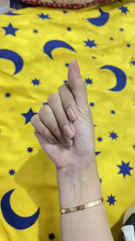 perempuan tidak bercerita tapi tangan & kakinya lebam