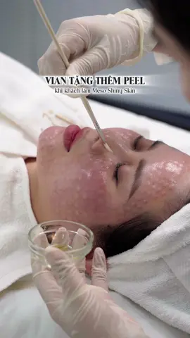 Meso còn nửa giá, tặng thêm Peel x3 hiệu quả căng bóng! Nhanh tay IB cho Vian dành những ưu đãi cuối cùng! #vianskinlab #peelmesotherapy #peeling #mesotherapy #căngbóng #trẻhoáda #cấpẩm 