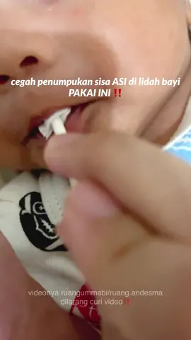 ternyata, kalau lidah bayi tidak dibersihkan, jamur bisa menumpuk dan meningkatkan resiko infeksi ‼️ Yuk rajin bersihkan lidah bayi 2x sehari 💐 #perlengkapanbayi #perlengkapanbayibarulahir #baby #newborn #fyp #xybca #babyoralcare #lewatberandafyp 