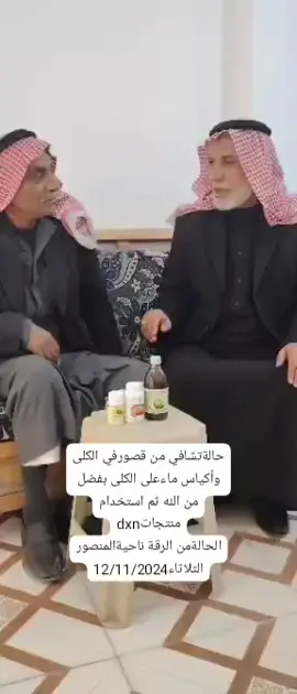 #عسل #دبي #شعب_الصيني_ماله_حل😂😂 #CapCut #يمان 