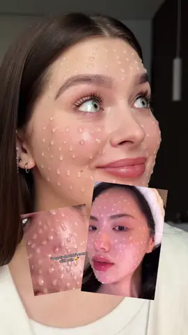 замовляла в інст: cosmetics_factory_ua🔥 #medipeel #spicule #spiculepeel #microneedling #microneedlingserum #serum #korean #koreanskincare #beauty #спікули #мікронідлінг 