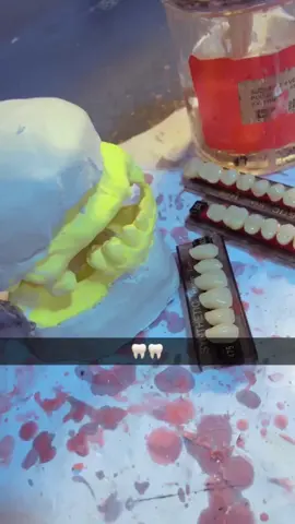Mounting teeth #prothesistedentaire  #mondedental #dentaltechnician #f #capcut_edit 