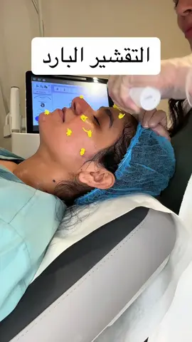خطوات التقشيرالبارد @عيادات الكسائي الطبية #رناالجيار #عناية_بالبشرة #تجميل #تقشير_البشرة #تقشير_البشرة #تقشير_بارد #عنايه 