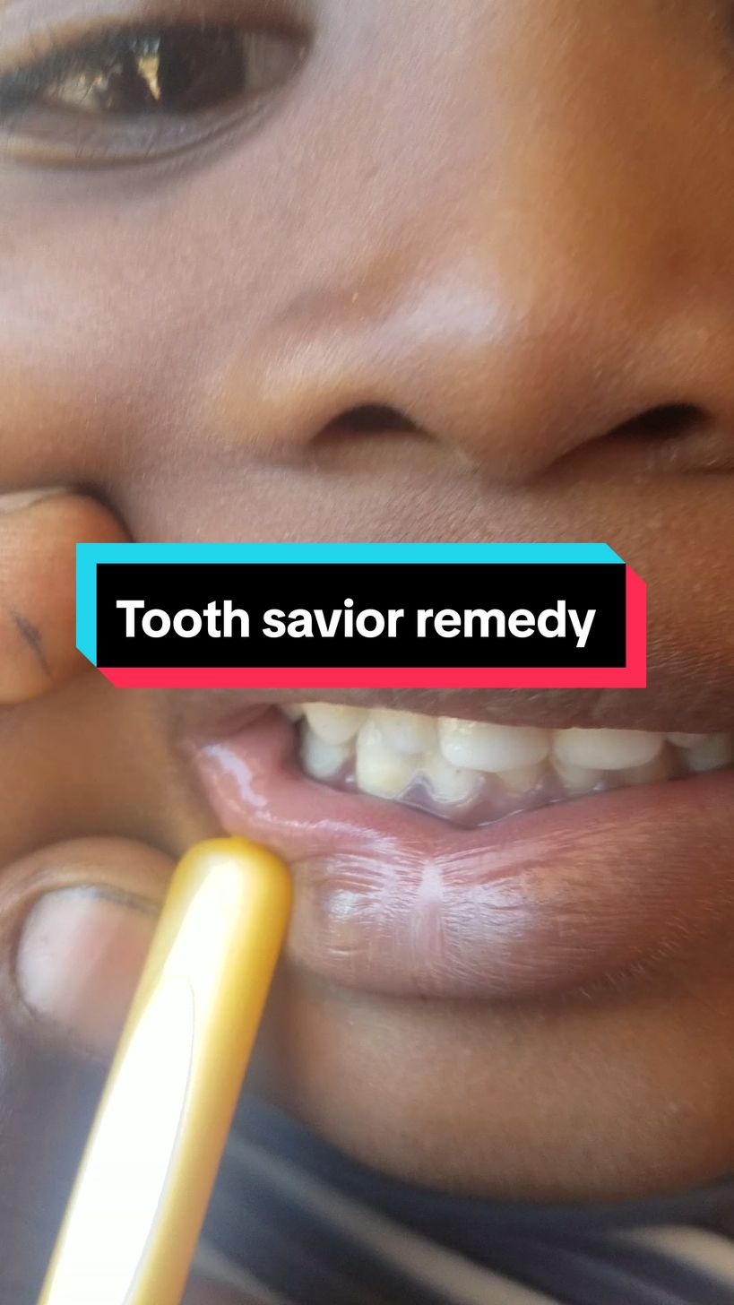 Tooth savior powder, natural remedy for whitening and other tooth related problems. #fyp #tiktokviral #toothsavior #teethwhitening #trendingvideo #nairobiviral #creatorsearchinsights #healthwise #foryoupage❤️❤️ 
