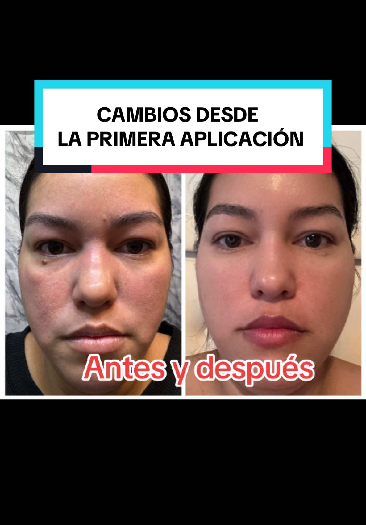 Mejora el estado general de la piel PRUEBALO 💗💗✨para un viaje de resplandor ✨#medicube #tiktokshop #medicubetiktokshop #tiktokshopping #tiktokshopproducts #tiktokshopviral #kbeauty #koreanskincare #skincare #jellycream #koreanglassskin 