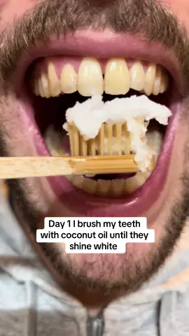 Day 1 I brush my theeth until they shine white 🤩 #teethwhitening#teeth#coconut